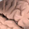 Brain Surgery Game HD Image