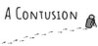 A Contusion