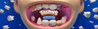 Titans Clinic Image